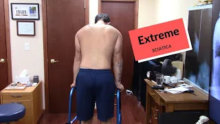 EXTREME Sciatic Pain HELPED by Dr Suh Gonstead Chiropractic NYC