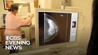 New guidelines recommend less frequent mammograms for some women