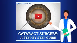 What to Expect During & After Cataract Surgery