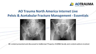 Pelvic & Acetabular Fracture Management  Essentials Week 1