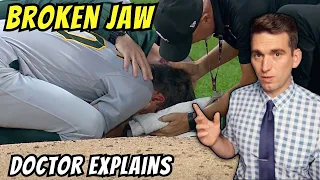 Chris Bassitt Breaks Jaw after Getting Hit with 100mph Line Drive - Doctor Explains