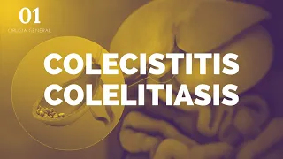 Colecistitis y Colelitiasis - ENARM