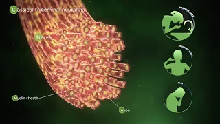 Mechanism of Disease: TN