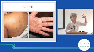 PHARMAC seminar: Dermatology update, ageing skin part 3