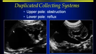 RenalAdrenalRetroperitoneal Ultrasound