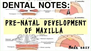 PRENATAL DEVELOPMENT OF MAXILLA II GROWTH OF MAXILLA II EMBRYOLOGY II ORTHODONTICS