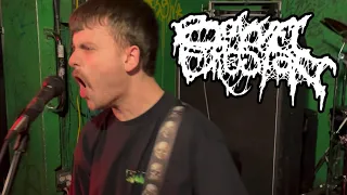 Bowel Erosion - Live in Montclair NJ - May 11, 2024