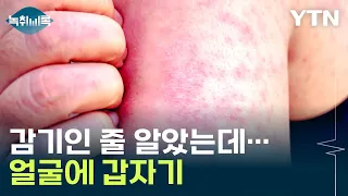 감기·독감과 증세 비슷...'전 세계 유행' 역병 국내 상륙 [Y녹취록] / YTN