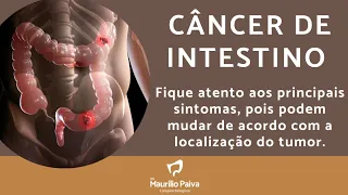 Câncer de Intestino: fique atento! Os sintomas podem mudar dependendo da localização do tumor.