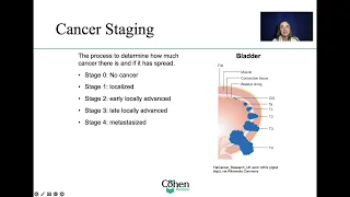 Cancer - with a focus on Staging for the NP boards