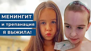 Менингит привёл к трепанации черепа / Менингит у детей, Альбина 9 лет