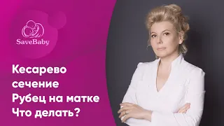 Кесарево сечение: расхождение матки по рубцу. Что делать? Акушер-гинеколог