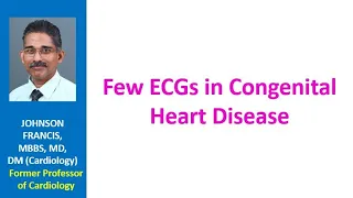 Few ECGs in Congenital Heart Disease