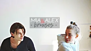 mia & alex • bruises