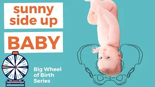 OP PRESENTATION: What is a sunny side up baby? | OP Baby