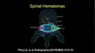 MRI of the Lumbar Spine | Part 8 - Lumbar Trauma