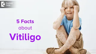 Is vitiligo more common nowadays? | Triggers, Prevention & Cure - Dr.  Nischal K C | Doctors' Circle