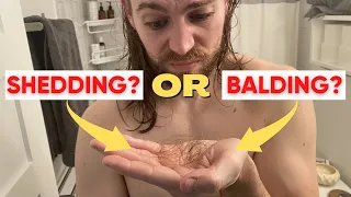 Are You Shedding Or Balding? (Telogen Effluvium Vs Male Pattern Baldness)