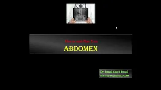 How to read Abdomen X-ray -Dr. Ismail Sayed Ismail
