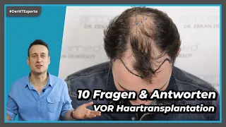 10 Dinge, die du VOR deiner Haartransplantation beachten musst