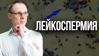 Лейкоспермия. Проблемы с зачатием. Врач уролог-андролог. Москва.