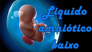 LIQUIDO AMNIÓTICO BAIXO - Saiba o que estou passando.