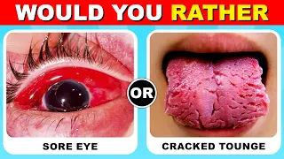 Would You Rather...? Hardest Choices Ever! 😱⚠️ EXTREME Edition | BrainQuiz