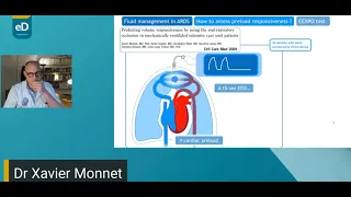 When and how to give fluids in ARDS Xavier  Monnet 2021