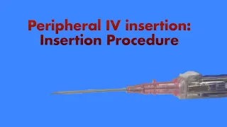 Peripheral IV Insertion: Insertion Procedure