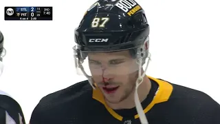 Sidney Crosby Bloodied after a skirmish with Niko Mikkola