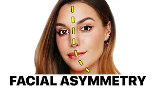 Marzia's 'Facial Asymmetry' | Surgeon Reacts