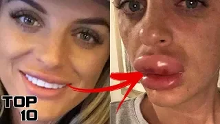 Top 10 Scary Plastic Surgery Disasters