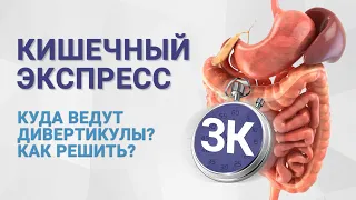 №3к КИШЕЧНЫЙ ЭКСПРЕСС. Куда ведут дивертикулы - как решить?