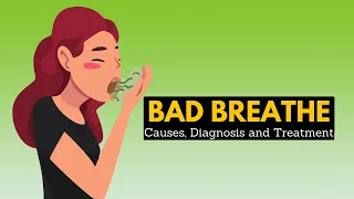Bad Breath (halitosis), Causes, Sign and Symptoms, Diagnosis and Treatment
