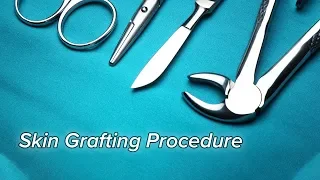 Skin Grafting Procedure