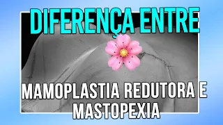 DIFERENÇA ENTRE MAMOPLASTIA REDUTORA E MASTOPEXIA - CIRURGIA PLÁSTICA