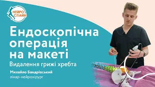 Видалення грижі хребта Київ. Ендоскопічна операція на макеті. Удаление межпозвоночной грыжи Киев