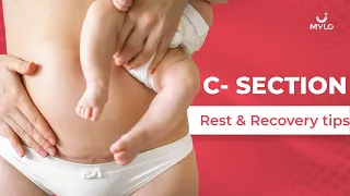 Sleeping Position After C-Section | Recovery Sleeping Positions After C-Section | Mylo Family