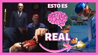 🧠 Operar el CEREBRO a PERSONAS DESPIERTAS ¿Cuáles son los riesgos de una operación en el cerebro?