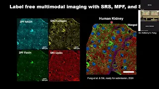 Pico-Second Laser Scanning Chemical-bond Imaging of Metabolic Activities in Aging and Diseases