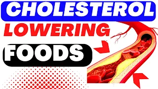 Top CHOLESTEROL LOWERING FOODS.