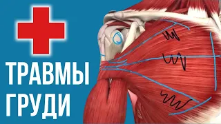 ТРАВМЫ ГРУДНЫХ МЫШЦ - разрыв, отрыв, растяжение, операции, лечение | Жим Лежа