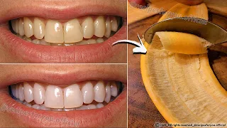 Secret that Dentists don't want you to know: Remove Tartar and Teeth Whitening in just 2 minutes🪥🦷