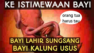 KEISTIMEWAAN BAYI LAHIR KALUNG USUS DAN LAHIR SUNGSANG