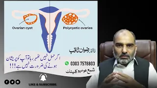 PCOS and Fibroids || اگر حمل نہیں ٹھہر رہا تو آپ کو پریشان ہونے کی ضرورت نہیں ہے || Dr. Rizwan Saqib