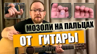 Сухие мозоли на пальцах от струн при игре на гитаре. Что делать и как убрать?