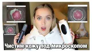 Розыгрыш 🔥Гаджеты с AliExpress.Лазерный эпилятор+чистка лица вакуумом