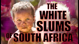 SOUTH AFRICAN WHITE SLUMS - The poverty in the White Squatter Camps