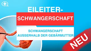 Was ist eine Eileiterschwangerschaft und warum kann sie gefährlich sein?