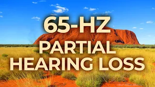 65-Hz Binaural Beat Music Therapy for Partial Hearing Loss & Deafness | Relaxing, Calming, Healing